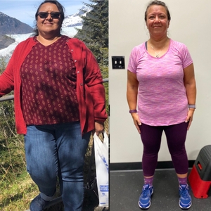 Debra before and after 
