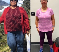Debra before and after 
