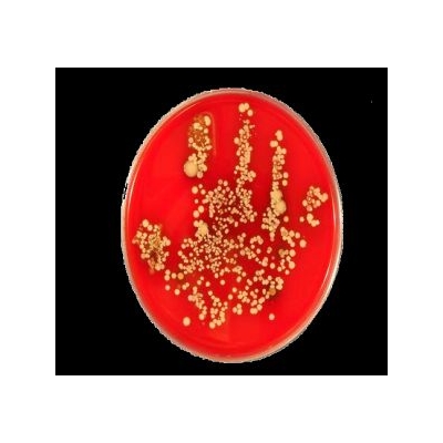 URMC, Lighthouse Biosciences Awarded U.S. Patent for Diagnostic Technology