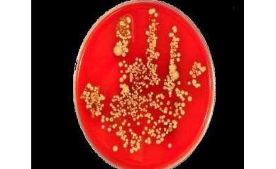 URMC, Lighthouse Biosciences Awarded U.S. Patent for Diagnostic Technology