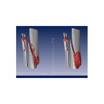 Scientists Discover Way to Jumpstart Bone's Healing Process