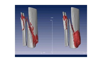 Scientists Discover Way to Jumpstart Bone's Healing Process