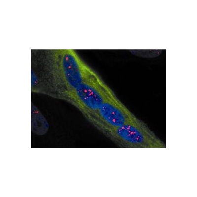 Genetic Source of Muscular Dystrophy Neutralized