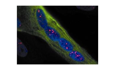 Genetic Source of Muscular Dystrophy Neutralized