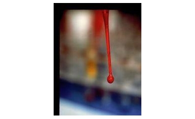 Blood Transfusion Study: Less is More