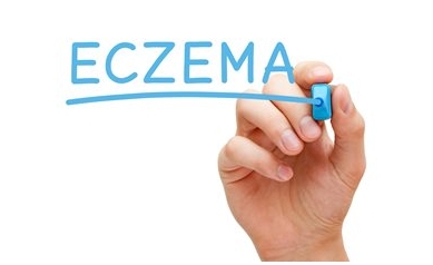 New Eczema Drug Brings Long-Awaited Relief