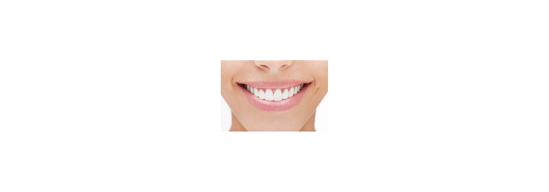 DIY Teeth Whitening: Too Good to Be True? - URMC.Rochester.edu