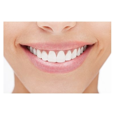 DIY Teeth Whitening: Too Good to Be True?