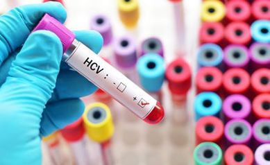 Hepatitis C: What You Need to Know