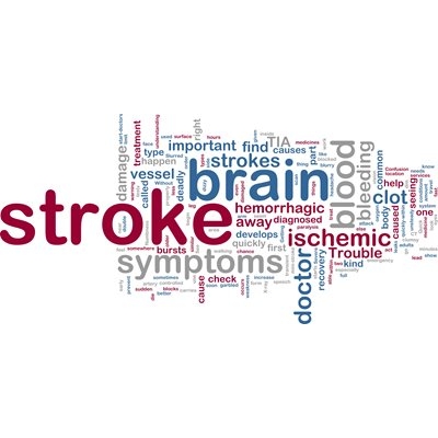 Stroke Care: Why Where You Go for Treatment Matters