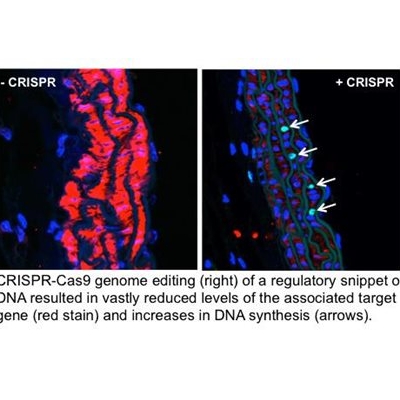 Gene Editing Technology Holds Huge Potential