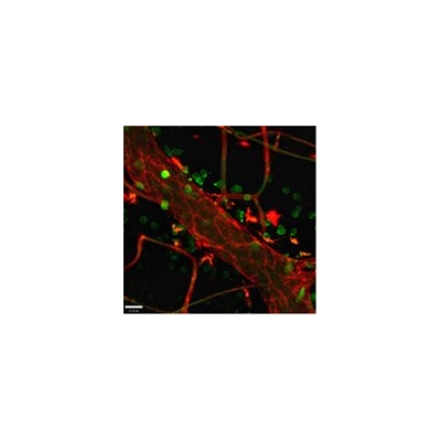Sepsis on the Rise: Researchers Receive $4 Million to Search for New Treatments