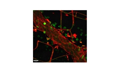 Sepsis on the Rise: Researchers Receive $4 Million to Search for New Treatments
