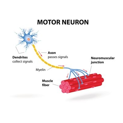 Researchers Spot New Neuromuscular Disorder