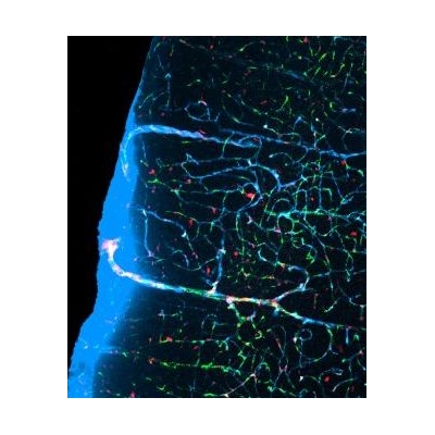 URMC Study Chosen as One of the “Breakthroughs of the Year”
