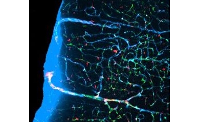 URMC Study Chosen as One of the “Breakthroughs of the Year”