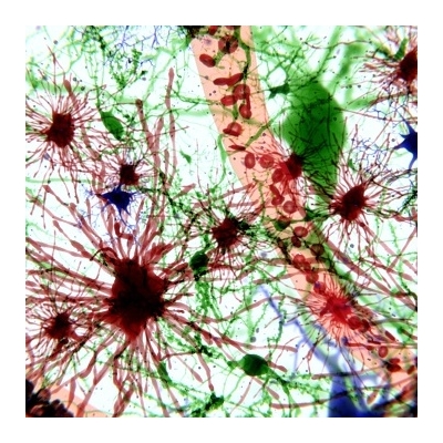 Protein Key to Nerve Health Hitches a Ride on Brain’s Garbage Truck