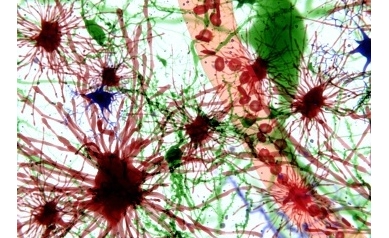 Protein Key to Nerve Health Hitches a Ride on Brain’s Garbage Truck