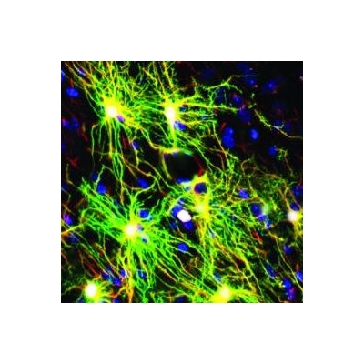 Brain’s Support Cells May Be Important Player in Schizophrenia