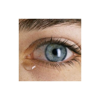 New URMC Clinic Tackles Little-Understood Dry Mouth, Eyes Disease
