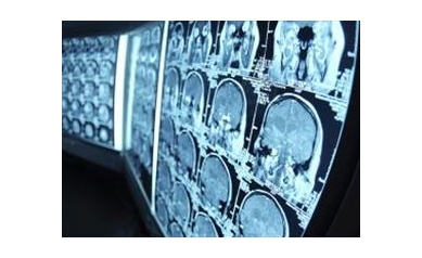 Variations in Decisions for Care of Patients with Brain Injury “Disturbing”