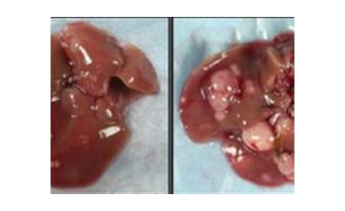 Androgen Receptor May Explain Male Dominance in Liver Cancer