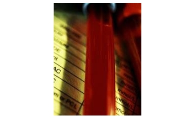 URMC Receives $1.5M to Study Safety of Blood Transfusions