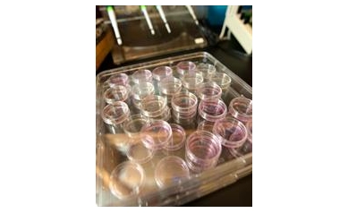 Wilmot Cancer Center Explores Research Collaboration With Roswell Park Cancer Institute