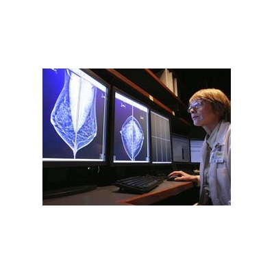 Wilmot Cancer Center Experts Offer Breast Health Tips Oct. 9