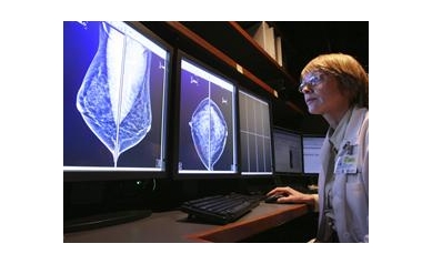 Wilmot Cancer Center Experts Offer Breast Health Tips Oct. 9