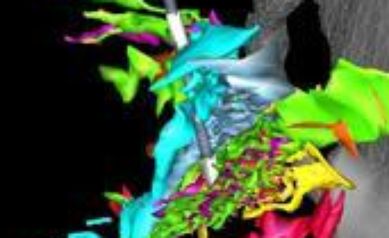Neuroscience Symposia Highlight Brain Research, Relevance for Patients