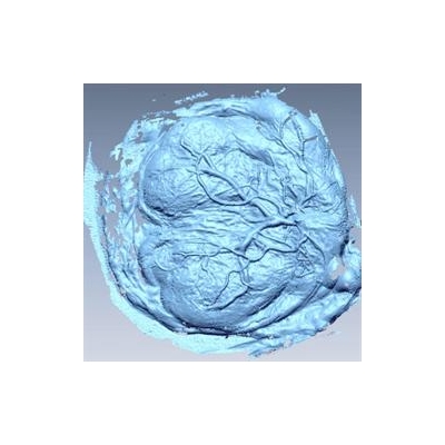 Researchers Study Afterbirth to Learn What Happens Before Birth and Beyond