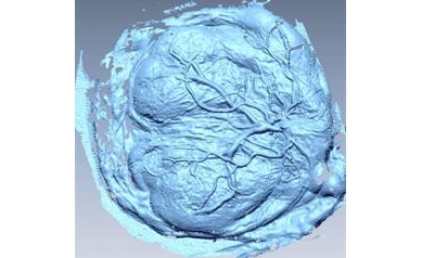 Researchers Study Afterbirth to Learn What Happens Before Birth and Beyond