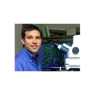 The Pericyte Becomes a Player in Alzheimer’s, Other Neurodegenerative Diseases