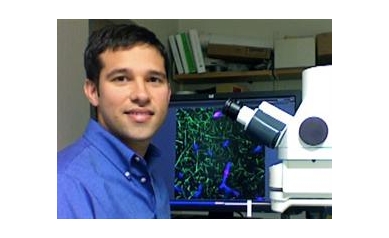 The Pericyte Becomes a Player in Alzheimer’s, Other Neurodegenerative Diseases