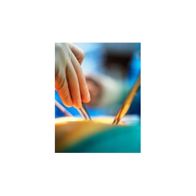 For Some, Laparoscopic Technique Not Always Better