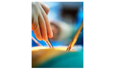 For Some, Laparoscopic Technique Not Always Better