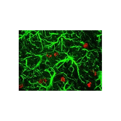 Anti-Depressants Boost Brain Cells after Injury in Early Studies