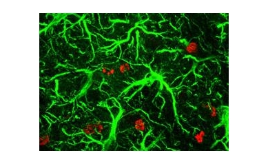 Anti-Depressants Boost Brain Cells after Injury in Early Studies