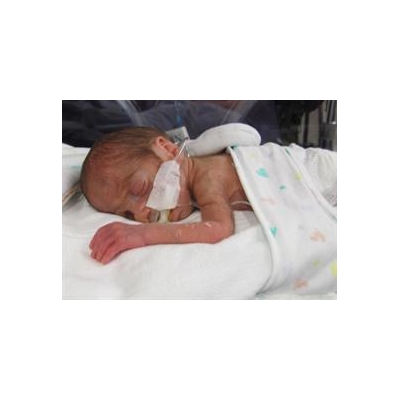 Golisano Children’s Hospital Joins National NICU Research Network