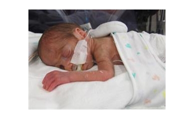 Golisano Children’s Hospital Joins National NICU Research Network