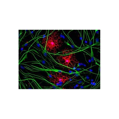 Stem Cell Efforts to Treat Neurological Disease Bolstered With $4.5 Million
