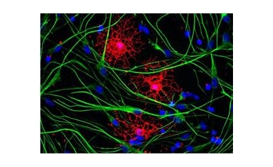 Stem Cell Efforts to Treat Neurological Disease Bolstered With $4.5 Million
