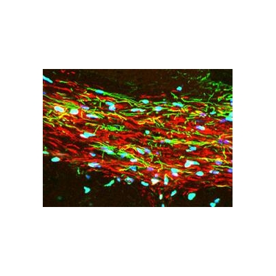 Precision with Stem Cells a Step Forward for Treating M.S., Other Diseases