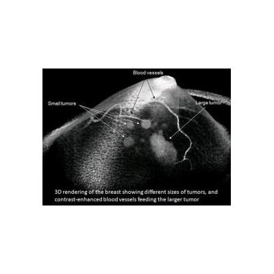 Koning Breast Scanner Receives European Regulatory Approval