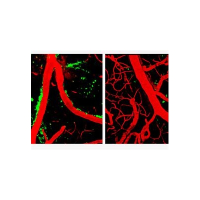 Alzheimer’s Gene Causes Brain’s Blood Vessels to Leak, Die
