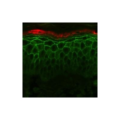 Scouring the Skin for Clues to Better Health