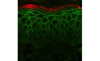 Scouring the Skin for Clues to Better Health