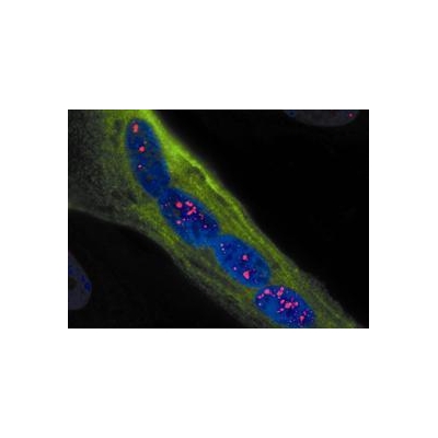 A Promising Step Forward Toward Muscular Dystrophy Treatment