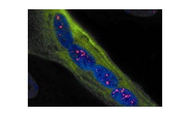 A Promising Step Forward Toward Muscular Dystrophy Treatment